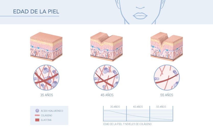 Inforgafía de las etapas de edad de la piel